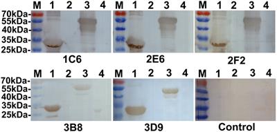 Generation of Monoclonal Antibodies against Ag85A Antigen of Mycobacterium tuberculosis and Application in a Competitive ELISA for Serodiagnosis of Bovine Tuberculosis